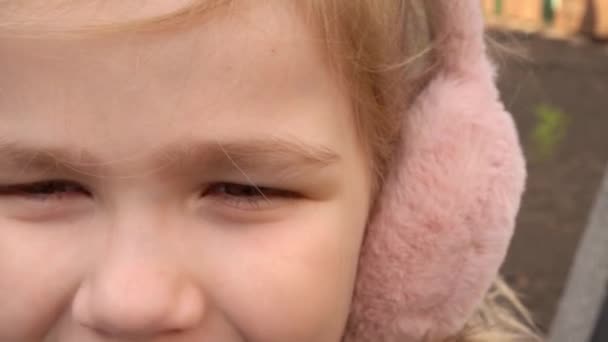 Tutup. Sebuah memar pada seorang gadis kecil yang menyedihkan mata kiri. kelopak mata memar. — Stok Video