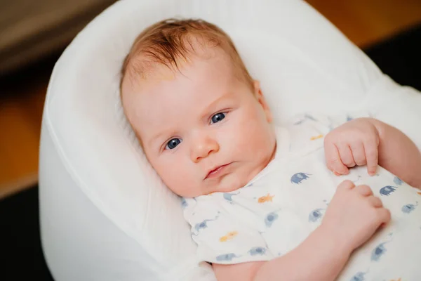 Infant on a white lounger. seborrheic dermatitis on the babys head. — Stock Photo, Image