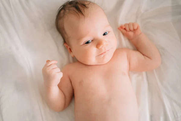 Um bebê com dermatite seborreica na cabeça repousa sobre um lençol branco. acolhimento de crianças. — Fotografia de Stock