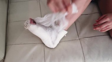 Bacağındaki bandajlar gevşemiş, yaralanma üstüne alçı ya da ortopedik ameliyat çıkarılmış..