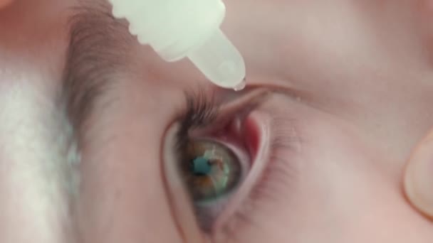 Eye drops. in inflamed eyes dripping drops. vision problems. — Stock Video