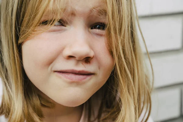 Portrait Mädchen mit einer Schürfwunde unter dem Auge. Kindesmissbrauch. Wunden und Schürfwunden — Stockfoto