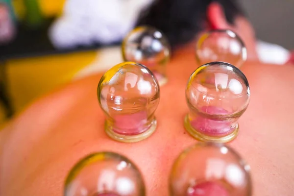 Süpürge kutuları. Sırt masajı. Sırtında vakum masajı, erkek vücudu..