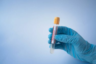 Nipah virüsü. Cam test tüpü tutan tıbbi maske takan genç bir kadın. Nipah Henipavirus, yarasa kaynaklı yeni ortaya çıkan bir virüs. Nipah virüsü enfeksiyonu. seçici odak