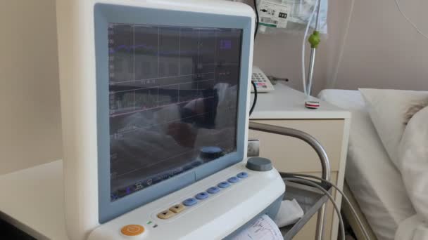 Övervakning baby hjärta foster test på gravida kvinna mage bälten. Hälsodiagnostik på sjukhuset — Stockvideo