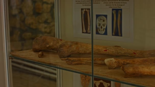 Closeup visning af virkelige menneskelige kranium og knogler i museet som blev fundet under historiske udgravninger. Set gennem glas af display. Real time 4k video optagelser – Stock-video