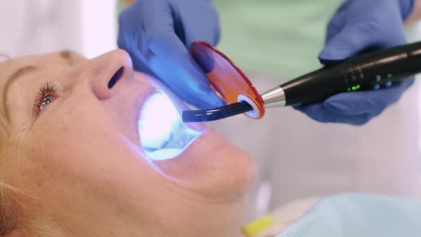 Kadın dişlerinde ultraviyole lamba kullanan bir dişçi. — Stok video