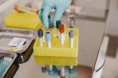 Doktor muayenehanesindeki hastadan kan örneği alan hemşire.