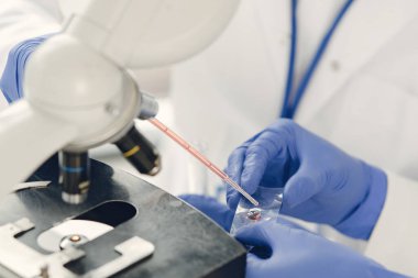 Tanımlanamayan laboratuar çalışanı mikroskop altında kan örneklerini inceliyor.