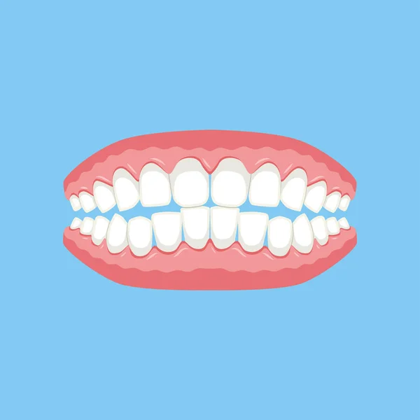 Denture Dziąsła Zębami Lub Protezami Tak Ilustracja Wektora — Wektor stockowy