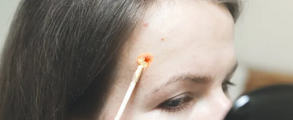 Mujer Está Cubriendo Acné Con Corrector Maquillaje Para Piel Grasa — Foto de Stock