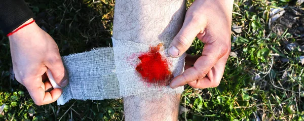 Man is putting bandage on bleeding wound. Injured leg. Tourist in the nature. Infection danger. Medical treatment. Hiking trauma.
