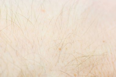 Kıl dokusuna sahip insan derisi. Makro fotoğraf, kapat..