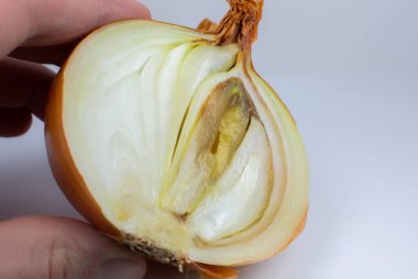 Bozuk, çürük soğan. Hastalık, sebze hastalığı. Kapat..