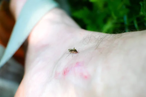 Κουνούπι Κάθεται Στο Πόδι Έντομα Δαγκώνουν Καλοκαίρι Επικίνδυνη Φύση Φαγούρα — Φωτογραφία Αρχείου