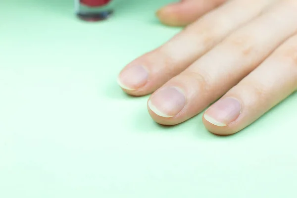Mão Feminina Antes Procedimento Manicure — Fotografia de Stock