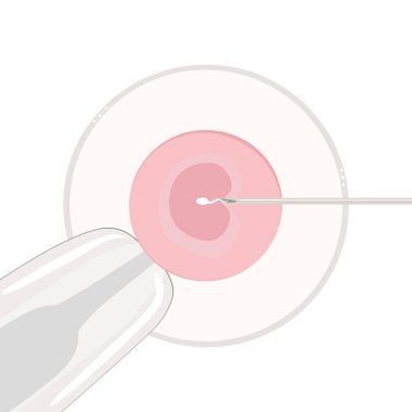 Düz vektör suni döllenme. Tüp bebek. Mikroskop altında bir hücre. Pipette yumurtayı tutar ve sperm iğneden çıkar. Beyaz arkaplanda yakın plan.