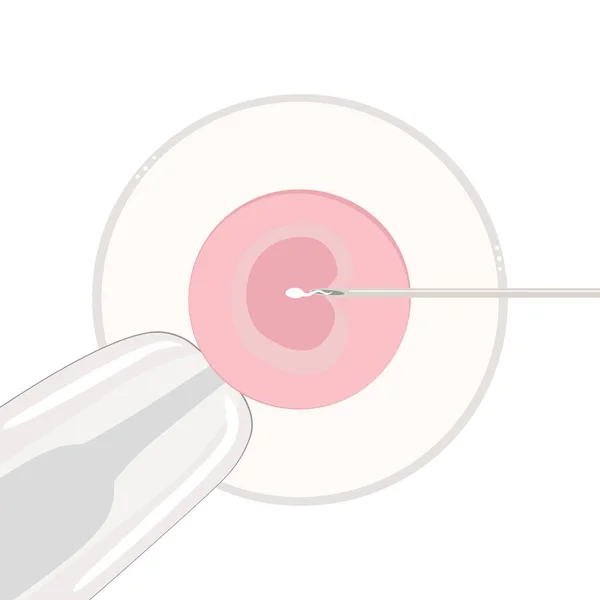 Плоска Векторна Ілюстрація Запліднення Vitro Клітина Під Мікроскопом Піпетт Тримає — стоковий вектор