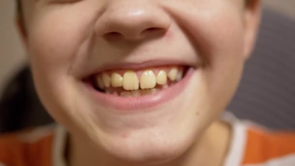 Funny Portrait of Laughing Child, Who Smiling, Showing an Open Mouth with Teeth — Stock Video