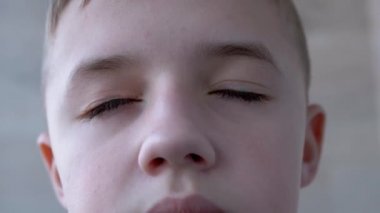 Göz kapağının yukarısından sarkan çocuk, Uzun Kırbaçlamalar, Tamamen Kapalı Olmayan Gözler