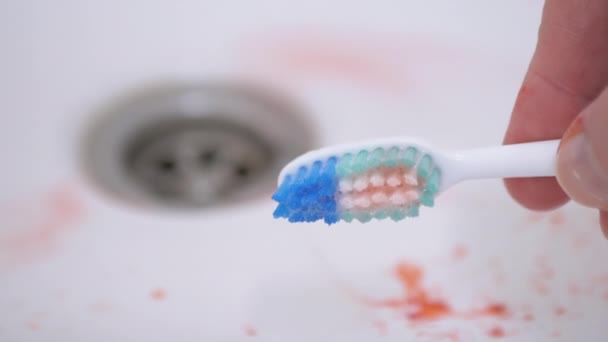 Femmina mano corre un dito di Bloody Bristles di uno spazzolino da denti. Problemi alle gengive. 4K — Video Stock