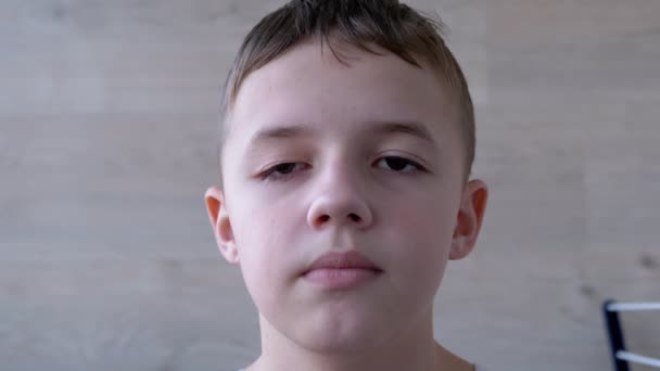 Boy with Drooping Upper of Eyelid, Long Lashes. Blinking Eyes. Operated Ptosis — Stock Video