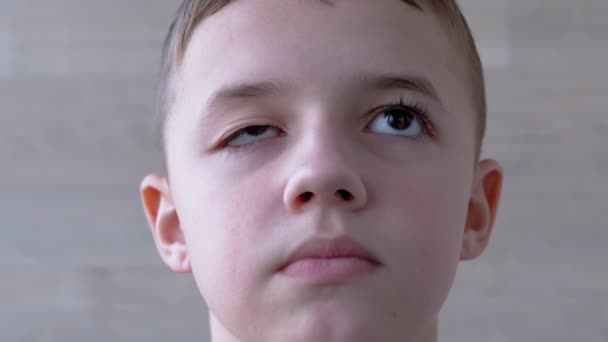 Niño con caída superior del párpado, pestañas largas. Miopía. Rotación de la pupila, ojos — Vídeos de Stock