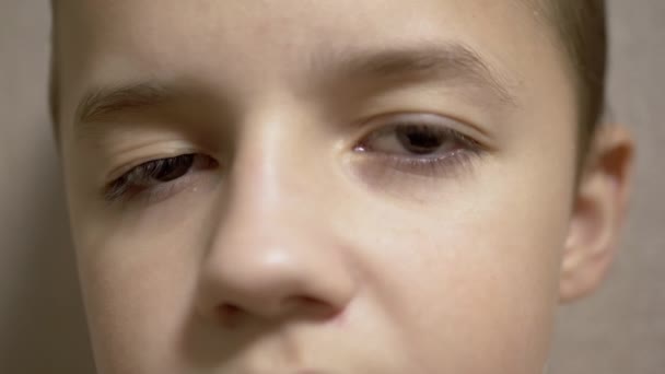 Ptosis van de bovenste ooglid in Boy Long Eyelashes. Myopie. Rollende pupil onder de ooglid — Stockvideo