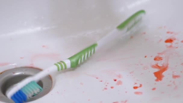 Bloed op tandenborstel wordt afgewassen met stromend water in de gootsteen. Probleem met aluminium — Stockvideo