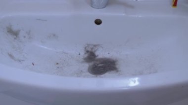 Lavabo saç, yün ve enkazla tıkanmış. Kanalizasyon tıkanması. 4K