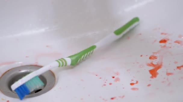 Sangue na escova de dentes é lavado com água corrente no dissipador. Problema da pastilha elástica. 4K — Vídeo de Stock