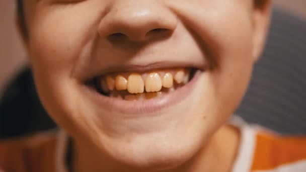 Retrato divertido de niño riéndose, que sonríe, mostrando una boca abierta con dientes — Vídeos de Stock