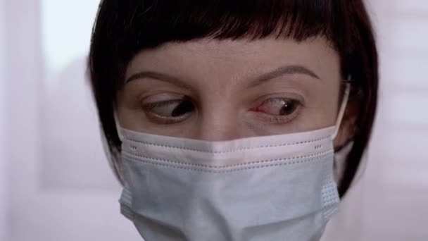 Jeune fille en masque tourne rouge, yeux injectés de sang. Conjonctivite virale. 4K — Video