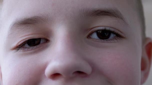 Smiling Boy with Drooping Upper of Eyelid, Long Lashes. Myopia. Ptosis. Zoom — Stock Video