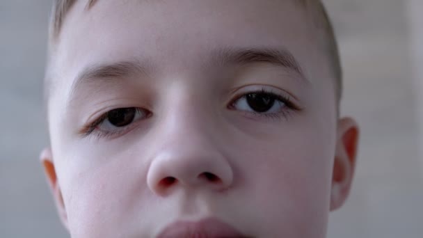 Niño adolescente con caída superior del párpado, pestañas largas. Miopía. Ptosis operada. 4K — Vídeos de Stock