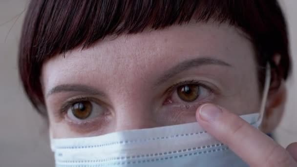 Chica joven con máscara gira rojo, ojos de bala de sangre. Conjuntivitis viral. 4K — Vídeos de Stock