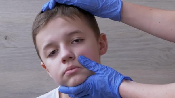 El doctor otorrinolaringólogo limpia las orejas, canal del oído de un niño con un hisopo de algodón — Vídeos de Stock