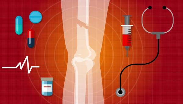 Fratura óssea pernas quebradas anatomia humana raio-x tratamento médico ilustração ícone —  Vetores de Stock