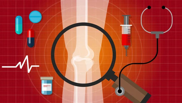 Artritis articulación problema óseo salud ilustración reumatoide — Vector de stock