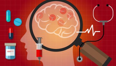 Alzheimer parkinson beyin kanser ilaç anatomi tıbbi sağlık tedavi hastalığı