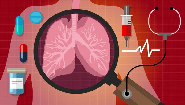 Long respiratoire kanker kuur medicatie anatomie medische zorg — Stockvector