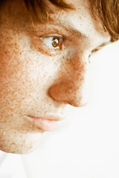 Man with freckles on face — Stock Photo, Image