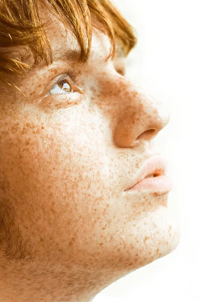 Hombre con pecas en la cara — Foto de Stock