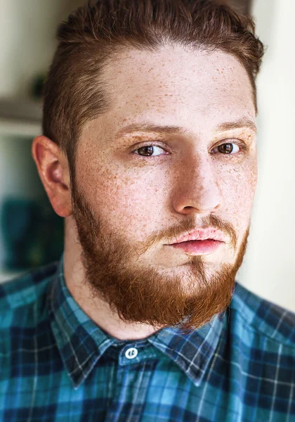 Man with freckles on face — Stock Photo, Image