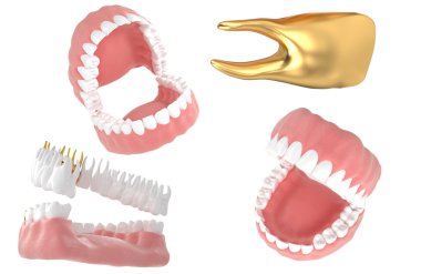 jaw27