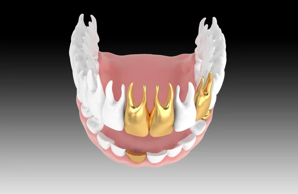 Jaw5 — Stock Photo, Image