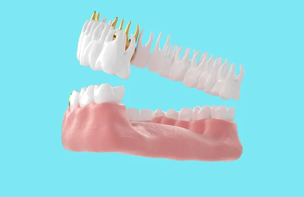 Jaw9 — Stock Photo, Image