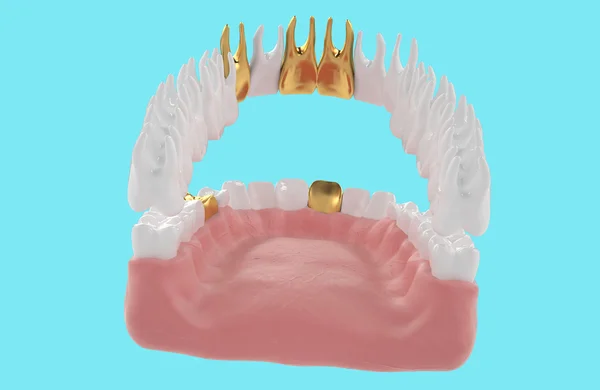 Jaw1 — Zdjęcie stockowe