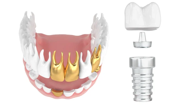 Jaw42 — 스톡 사진