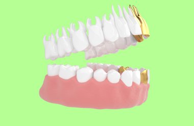 jaw56